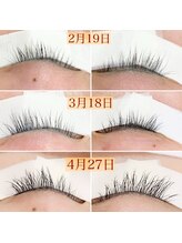 ロア(Loa)/美容液効果☆