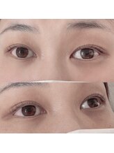 リボーテ(Reboaute)/アップフォースリフト