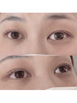 リボーテ(Reboaute)/アップフォースリフト