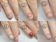 プチムトン 鶯谷店(petit mouton)/【深爪矯正コース】2