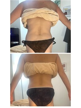 レア ルアン 西口店/ブライダルエステにもおすすめ