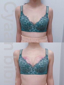 シアンビビ(Cyaan bibi)/