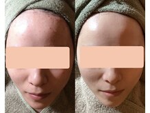 ハナレイ(hanalei)の雰囲気（「結果を生み出す美のサイエンス」エンビロンは美肌管理に◎）