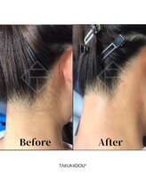 チア(Cheer)/うなじワックス