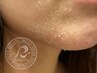 【Face】剥離ありリベルハーブピーリング ¥22000/新規☆次回使える¥3000券
