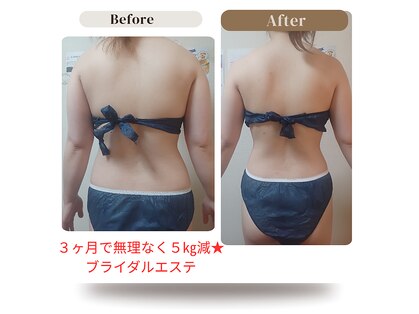 プライベートエステ カモミールの写真