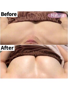 ナトゥーラ 心斎橋なんば本店(Natura)/ボリュームアップ美バスト★難波