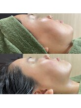 オルラプレ('olulapule)/フォーエバーヤングブライダル