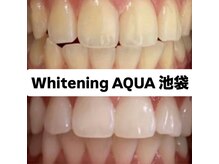 アクア 池袋店(AQUA)/ホワイトニング/池袋/東京/美白
