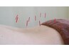 何度でも♪　【自律神経/眼精疲労/不眠/頭痛に】 鍼施術+整体75分 ¥7500