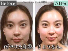 グレースフィオーレ 南越谷店(gracefiore)