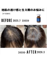 サンシー整体(SunCY整体)/６０代女性