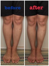 激痛ダイエット整体 八巻/ビフォーアフター！/マッサージ