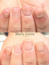 マリーロール 梅田店(Marie Laure)/自爪育成/深爪矯正/ネイルケア