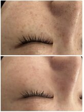 プランス 渋谷(PLANCE)/毛穴/ハーブ/ニキビケア