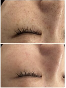 プランス 渋谷(PLANCE)/毛穴/ハーブ/ニキビケア