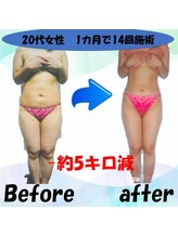 フェリス.ディア(Feliz.Dia)/【ビフォーアフター4】