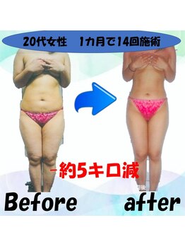 フェリス.ディア(Feliz.Dia)/【ビフォーアフター4】