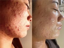 ソイズ 新保店(SOIS)/V.O.Sサロンケア