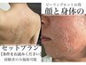 経験者のみ施術可『剥けるピーリングのセットプラン』ブライダル前もオススメ