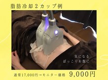 ブルースター 上小田井店(Blue Star)/脂肪冷却/２カップ