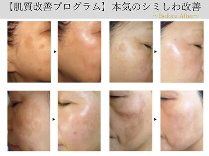 ブライス(BLITHE)の写真