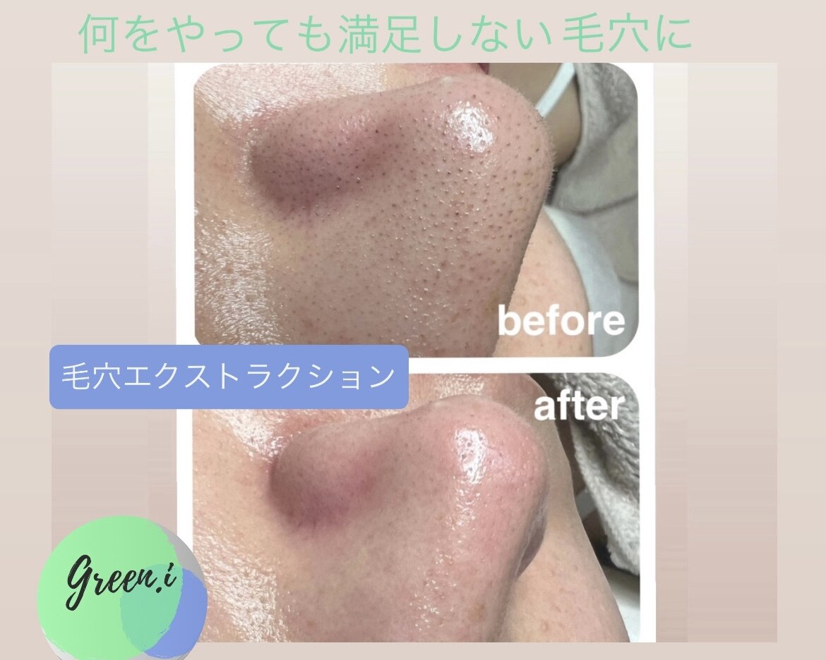 エステティックサロン グリーンアイ 浦和店(green.i)｜ホットペッパー