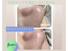 エステティックサロン グリーンアイ 浦和店(green.i)