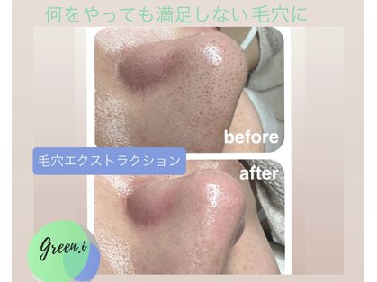 エステティックサロン グリーンアイ 浦和店(green.i)の写真