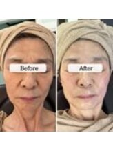 ル ボヌール 伊那店(le bonheur)/月1回で印象劇的変化♪