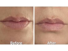 アン 銀座(ann)/唇プルルン