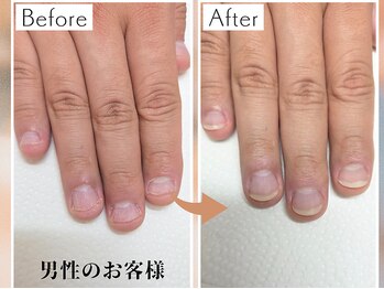 キュアネイル(Qa Nail)