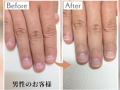 キュアネイル(Qa Nail)の写真