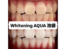 アクア 池袋店(AQUA)/ホワイトニング/池袋/東京/美白