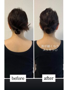 グリッター ショウナン(glitter. SHONAN)/たった1度でこの変化/藤沢整体