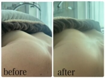 エクラニーク(Eclanique)/まき肩調整＋ふっくらバスト