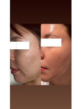 ダリア(Dahlia)/インセルダム