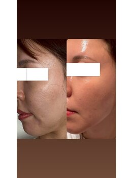 ダリア(Dahlia)/インセルダム