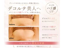 ミオ(MIO)の雰囲気（垂れバスト撃退！姿勢改善からも美バストへ導きます。）