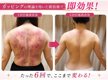 ルセラ(LUCERA)の写真