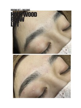 イルス(Ilus)/ハリウッドブロウリフト