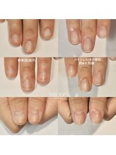 ニコプラス(NICO+)/自爪育成中