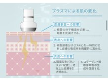 リン(RIN)の雰囲気（オススメ！プラズマゼノデュアル！月一メンテで毛穴縮小へ！）