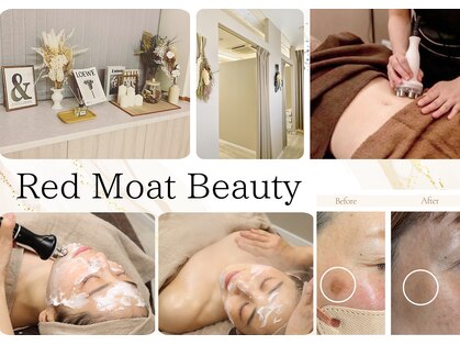 レッドモート(Red moat)の写真