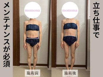 モモナ(Momona)/#肩こり#リンパマッサージ#野並