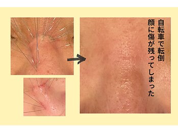 はりきゅう和 ルート鍼灸院/同じ場所