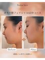 バービーフェイス 恵比寿(Barbie Face)&nbsp;【本気の小顔】スッキリ小顔＋凝り固まった肩こり徹底改善60分