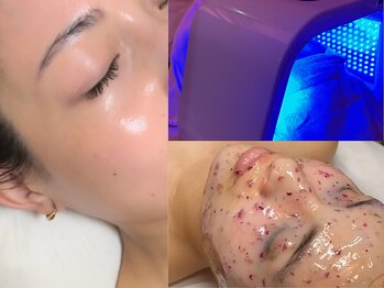 レネットサロン(Reinette Salon)の写真/【浸透率劇変】大人女子のご褒美。希少ワックスx光のW脱毛&ハイドロマスクxLEDで極上顔脱毛 13,200円