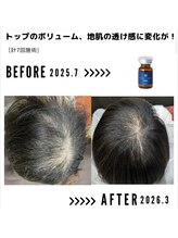 サンシー整体(SunCY整体)/４０代女性