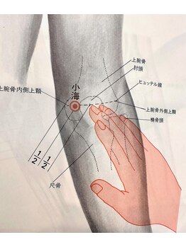 アノン 松山(Anon)/ツボ